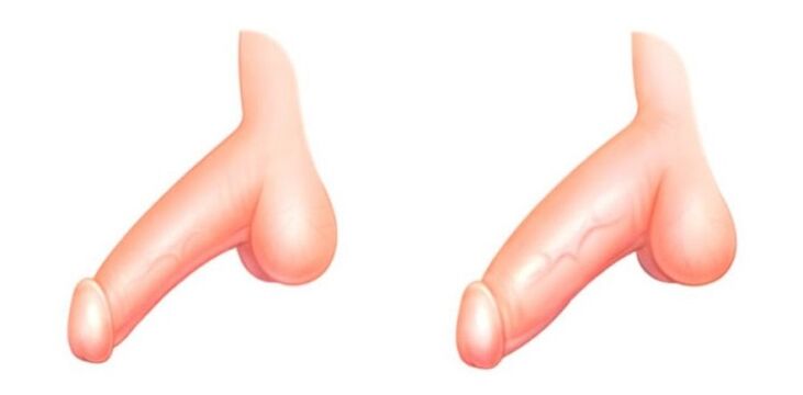 zakila handitu aurretik eta ondoren